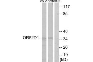 Western blot analysis of extracts from COLO cells and COS cells, using OR52D1 antibody. (OR52D1 anticorps  (C-Term))