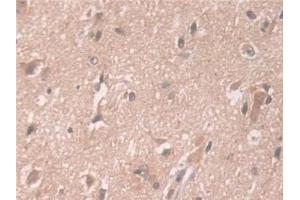 Detection of ATP7b in Human Cerebrum Tissue using Polyclonal Antibody to ATPase, Cu++ Transporting Beta Polypeptide (ATP7b)