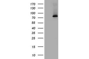 Image no. 1 for anti-RAS Guanyl Releasing Protein 3 (Calcium and DAG-Regulated) (RASGRP3) (AA 380-690) antibody (ABIN1491477)