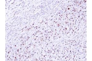 IHC-P Image Immunohistochemical analysis of paraffin-embedded SAS xenograft , using DRAK1, antibody at 1:500 dilution.