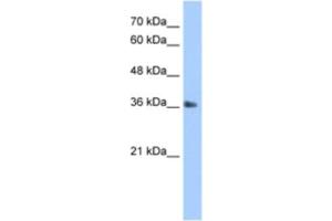 Western Blotting (WB) image for anti-TIMELESS Interacting Protein (TIPIN) antibody (ABIN2463351) (TIPIN anticorps)