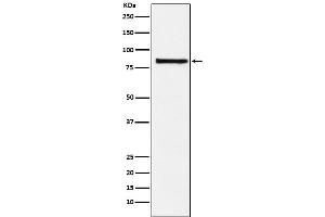 Western blot analysis of eIF2B epsilon expression in Hela cell lysate.