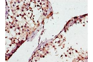 Immunohistochemistry of paraffin-embedded human testis tissue using ABIN7163370 at dilution of 1:100