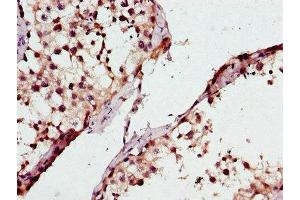 Immunohistochemistry of paraffin-embedded human testis tissue using ABIN7163370 at dilution of 1:100 (ATP8A2 anticorps  (AA 358-570))