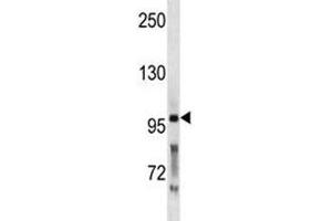 PCSK5 antibody western blot analysis in WiDr lysate. (PCSK5 anticorps  (AA 95-124))