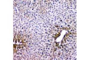 IHC analysis of RMI2 using anti-RMI2 antibody (ABIN6719656). (RMI2 anticorps)