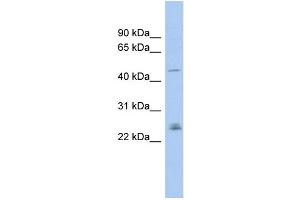 WB Suggested Anti-DMRT3 Antibody Titration: 0. (DMRT3 anticorps  (Middle Region))