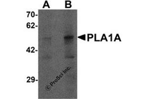 Western Blotting (WB) image for anti-Phospholipase A1 Member A (PLA1A) (C-Term) antibody (ABIN1077384)