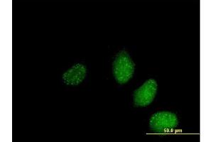 Immunofluorescence of  purified  MaxPab antibody to NS4ATP2 on HeLa cell. (SAP30L anticorps  (AA 1-183))
