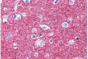 Human Brain, Putamen, Neuropil (formalin-fixed, paraffin-embedded) stained with GAP43 antibody ABIN305762 at 5 ug/ml followed by biotinylated anti-mouse IgG secondary antibody ABIN481714, alkaline phosphatase-streptavidin and chromogen.