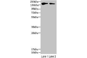 Western blot All lanes: FYCO1 antibody at 2. (FYCO1 anticorps  (AA 2-255))