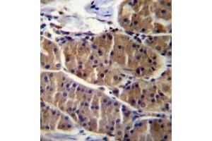 Immunohistochemistry analysis in formalin fixed and paraffin embedded human stomach tissue reacted with LRSAM1 Antibody (N-term) followed which was peroxidase conjugated to the secondary antibody and   followed by DAB staining.