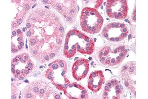 HNF1A antibody was used for immunohistochemistry at a concentration of 4-8 ug/ml.