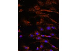 Immunofluorescence analysis of C6 cells using S2 antibody (ABIN7265451) at dilution of 1:100. (AP3S2 anticorps  (AA 1-193))
