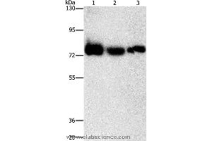 Western blot analysis of Human fetal muscle tissue, K562 and hela cell, using AMPD1 Polyclonal Antibody at dilution of 1:1600 (AMPD1 anticorps)