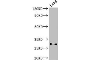 Western Blot Positive WB detected in: Mouse lung tissue All lanes: SPINT2 antibody at 3 μg/mL Secondary Goat polyclonal to rabbit IgG at 1/50000 dilution Predicted band size: 29, 22 kDa Observed band size: 29 kDa (SPINT2 anticorps  (AA 71-194))