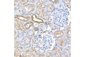 Immunohistochemistry of paraffin-embedded rat kidney using GCN2 Rabbit pAb (ABIN6127829, ABIN6140031, ABIN6140033 and ABIN6216318) at dilution of 1:250 (40x lens). (GCN2 anticorps  (AA 1-300))
