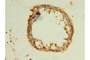 Immunohistochemistry of paraffin-embedded human testis tissue using ABIN7175746 at dilution of 1:100 (WDR37 anticorps  (AA 1-264))