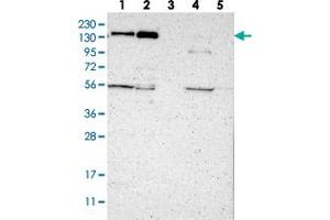 Western blot analysis of Lane 1: RT-4, Lane 2: U-251 MG, Lane 3: Human Plasma, Lane 4: Liver, Lane 5: Tonsil with JMJD2A polyclonal antibody  at 1:250-1:500 dilution. (KDM4A anticorps)