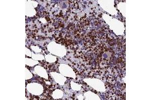 Immunohistochemical staining of human bone marrow with C19orf48 polyclonal antibody  shows strong cytoplasmic positivity in hematopoietic cells. (C19orf48 anticorps)