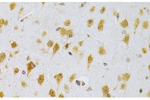 Immunohistochemistry of paraffin-embedded Mouse brain using MDM2 Polyclonal Antibody at dilution of 1:200 (40x lens). (MDM2 anticorps)