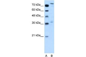 WB Suggested Anti-NFE2L3 Antibody Titration:  0. (NFE2L3 anticorps  (Middle Region))