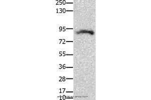 Western blot analysis of Mouse brain tissue, using KCNH2  Polyclonal Antibody at dilution of 1:100