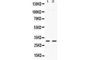 Western blot analysis of CA3 expression in rat cardiac muscle extract ( Lane 1) and mouse cardiac muscle extract ( Lane 2).