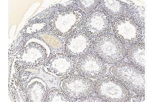 ABIN6266096 and ABIN6277656 at 1/100 staining mouse testis tissue by IHC-P.