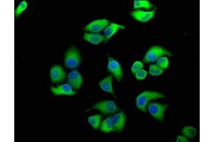 Immunofluorescence staining of Hela cells with ABIN7152141 at 1:100, counter-stained with DAPI. (PERK anticorps  (AA 115-330))