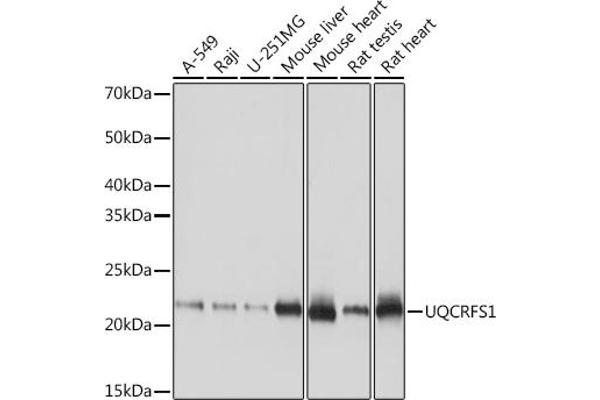 UQCRFS1 anticorps
