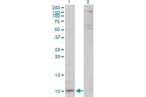 Western Blot analysis of CXCL5 expression in transfected 293T cell line by CXCL5 monoclonal antibody (M03), clone M1.