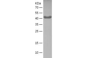 Western Blotting (WB) image for Autophagy Related 13 (ATG13) (AA 297-517) protein (His-IF2DI Tag) (ABIN7121950)