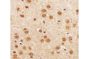 IHC analysis of FFPE mouse brain section using SIRT1 antibody at 1:25. (SIRT1 anticorps  (AA 566-601))