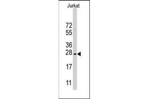 Western blot analysis of CLDN1 Antibody (Loop1) in Jurkat cell line lysates (35ug/lane). (Claudin 1 anticorps  (Loop 1))