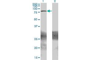 Western Blot analysis of ZBTB33 expression in transfected 293T cell line by ZBTB33 monoclonal antibody (M01A), clone 2B2. (ZBTB33 anticorps  (AA 564-673))