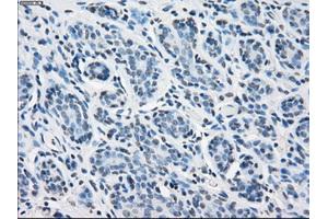 Immunohistochemical staining of paraffin-embedded breast tissue using anti-PSMA7 mouse monoclonal antibody. (PSMA7 anticorps)