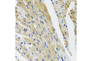 Immunohistochemistry of paraffin-embedded mouse heart using COPB2 antibody (ABIN5974232) at dilution of 1/100 (40x lens). (COPB2 anticorps)
