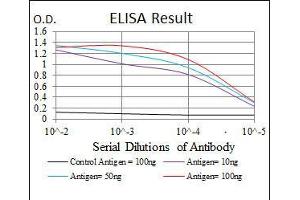 Black line: Control Antigen (100 ng), Purple line: Antigen(10 ng), Blue line: Antigen (50 ng), Red line: Antigen (100 ng), (NQO1 anticorps)