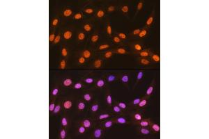 Immunofluorescence analysis of C6 cells using HP1 alpha/CBX5Rabbit mAb (ABIN1678748, ABIN3018030, ABIN3018031 and ABIN7101571) at dilution of 1:100 (40x lens).