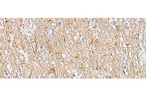 Immunohistochemistry of paraffin-embedded Human brain tissue using LRRC49 Polyclonal Antibody at dilution of 1:40(x200) (LRRC49 anticorps)
