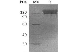 Western Blotting (WB) image for Platelet Derived Growth Factor Receptor alpha (PDGFRA) protein (Fc Tag) (ABIN7320624)