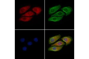 ABIN6256588 and ABIN6267381 staining Hela cells(4h of LPS treatment) by IF/ICC.