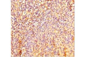 Immunohistochemistry of paraffin-embedded human tonsil tissue using ABIN7157778 at dilution of 1:100 (IL4I1 anticorps  (AA 139-339))