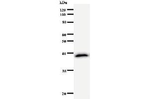 Western Blotting (WB) image for anti-CSRP2 Binding Protein (CSRP2BP) antibody (ABIN931052) (CSRP2BP anticorps)