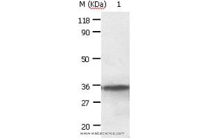 Western blot analysis of HepG2 cell, using ANXA2 Polyclonal Antibody at dilution of 1:640 (Annexin A2 anticorps)