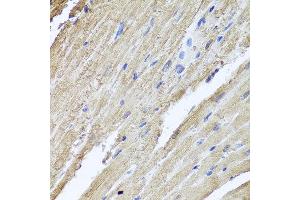 Immunohistochemistry of paraffin-embedded rat heart using PIK3C2A antibody at dilution of 1:100 (x40 lens).