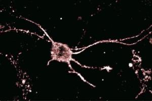 Immunofluorescence staining of rat neurons.