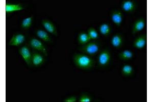 anti-CDK5 Regulatory Subunit Associated Protein 2 (CDK5RAP2) (AA 996-1111), (Regulatory Subunit) antibody