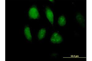 Immunofluorescence of purified MaxPab antibody to MLKL on HeLa cell. (MLKL anticorps  (AA 1-471))